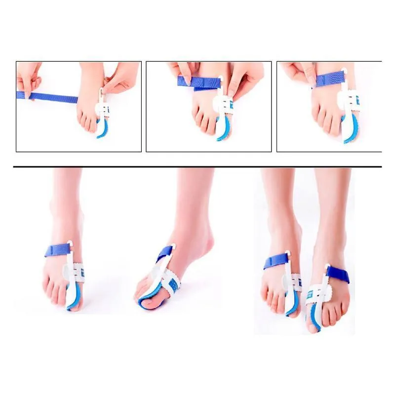 Orthopedic Bunion Corrector - Adjustable Size,  Night Use, Bunion Splint
